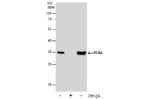 Image no. 8 for anti-Proliferating Cell Nuclear Antigen (PCNA) (Center) antibody (ABIN2854788)