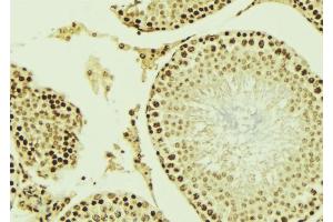 Image no. 3 for anti-Autoimmune Regulator (AIRE) (Internal Region) antibody (ABIN6266320)