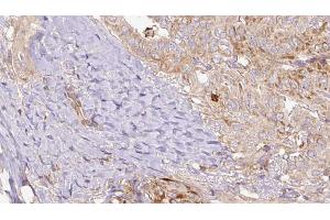 Image no. 1 for anti-RALBP1 Associated Eps Domain Containing 1 (REPS1) (pSer709) antibody (ABIN6255476)