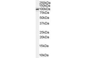 Image no. 1 for anti-Dihydropyrimidinase-Like 5 (DPYSL5) (C-Term) antibody (ABIN2789785)