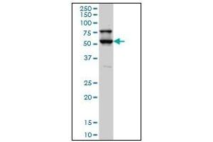 Image no. 3 for anti-serine/threonine Kinase 17a (STK17A) (AA 301-414) antibody (ABIN614691)