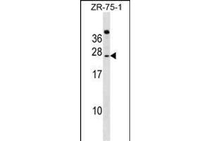 IGSF6 Antibody (Center) (ABIN1538572 and ABIN2849263) western blot analysis in ZR-75-1 cell line lysates (35 μg/lane).
