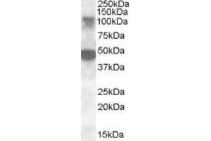 Image no. 1 for anti-serine/threonine Kinase 11 Interacting Protein (STK11IP) (Internal Region) antibody (ABIN308421)