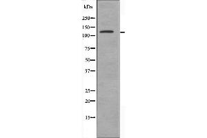 Image no. 1 for anti-Diacylglycerol Kinase, delta 130kDa (DGKD) (N-Term) antibody (ABIN6258760)