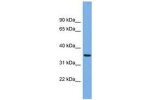 Image no. 1 for anti-Protease, serine, 22 (PRSS22) (AA 35-84) antibody (ABIN6745176)