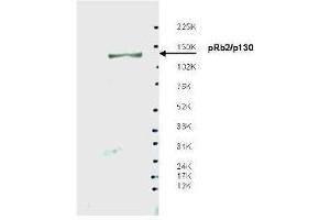 Image no. 1 for anti-Retinoblastoma-Like 2 (p130) (RBL2) antibody (ABIN349607)