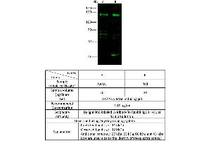 Image no. 4 for anti-Poly (ADP-Ribose) Polymerase 1 (PARP1) (Center) antibody (ABIN6924019)