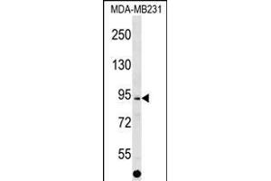ALS2CL Antibody (Center) (ABIN1538341 and ABIN2849165) western blot analysis in MDA-M cell line lysates (35 μg/lane).