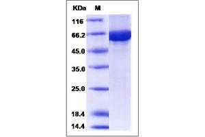 Image no. 1 for Cbl proto-oncogene C (CBLC) (AA 1-474) protein (GST tag,His tag) (ABIN2006591)