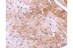 Image no. 1 for anti-Cell Death-Inducing DFFA-Like Effector A (CIDEA) (C-Term) antibody (ABIN499627)
