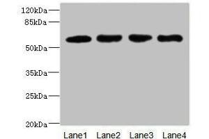 IL21 Receptor Antikörper  (AA 20-240)