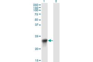 BLVRB antibody  (AA 107-206)