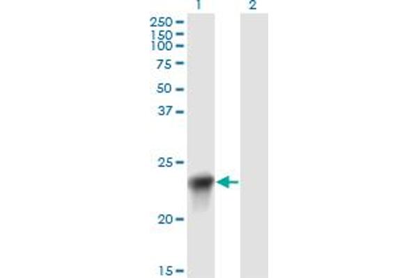 BLVRB antibody  (AA 107-206)