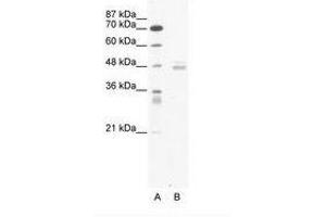 Image no. 1 for anti-LIM Domain Binding 1 (LDB1) (AA 251-300) antibody (ABIN6736052)