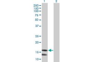 Image no. 1 for anti-Mitochondrial Ribosomal Protein L43 (MRPL43) (AA 1-159) antibody (ABIN529717)