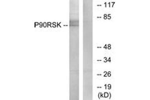 Image no. 3 for anti-Ribosomal Protein S6 Kinase, 90kDa, Polypeptide 3 (RPS6KA3) (AA 539-588) antibody (ABIN1532382)