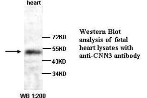 Image no. 1 for anti-Calponin 3, Acidic (CNN3) antibody (ABIN6583477)