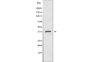 Image no. 3 for anti-Absent in Melanoma 2 (AIM2) (Internal Region) antibody (ABIN6256925)