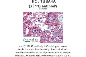 Image no. 3 for anti-Tubulin, alpha 4a (TUBA4A) (AA 1-449), (full length) antibody (ABIN1723613)