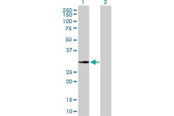 Endonuclease V antibody  (AA 1-264)