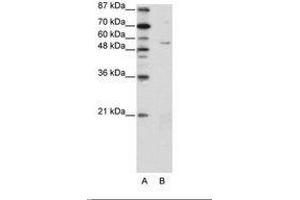 Image no. 1 for anti-Zinc Finger Protein 329 (ZNF329) (N-Term) antibody (ABIN202735)
