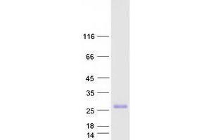 Image no. 1 for Transmembrane Inner Ear (TMIE) protein (Myc-DYKDDDDK Tag) (ABIN2733917)