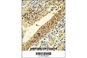 Image no. 2 for anti-Cytochrome P450, Family 51, Subfamily A, Polypeptide 1 (CYP51A1) (AA 250-279) antibody (ABIN652820)