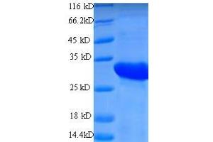 CD74 Antigen (Invariant Polypeptide of Major Histocompatibility Complex, Class II Antigen-Associated) (CD74) (AA 57-280) protein (His tag) expressed in E.