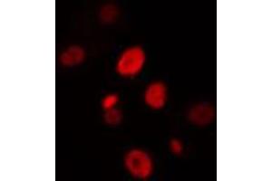 Image no. 2 for anti-Homeodomain Interacting Protein Kinase 4 (HIPK4) antibody (ABIN6257255)