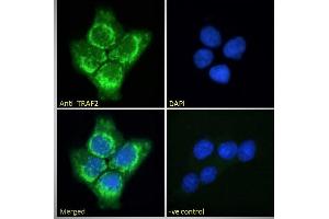 Image no. 5 for anti-TNF Receptor-Associated Factor 2 (TRAF2) (C-Term) antibody (ABIN190911)