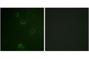 Image no. 3 for anti-Dynein, Axonemal, Heavy Chain 8 (DNAH8) (AA 5-54) antibody (ABIN1532320)