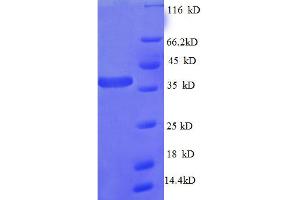 Image no. 1 for Ribosomal Protein L27 (RPL27) (AA 2-85) protein (GST tag) (ABIN5712640)