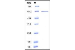 Image no. 1 for Histone Deacetylase 3 (HDAC3) (AA 1-428), (full length) protein (GST tag,His tag) (ABIN2004315)