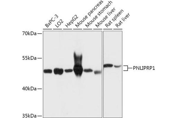 PNLIPRP1 antibody  (AA 298-467)