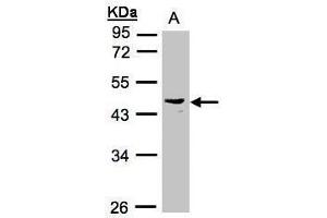 WB Image Sample(30 ug whole cell lysate) A:Raji , 10% SDS PAGE antibody diluted at 1:1000