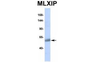 Image no. 8 for anti-MLX Interacting Protein (MLXIP) (Middle Region) antibody (ABIN2776519)