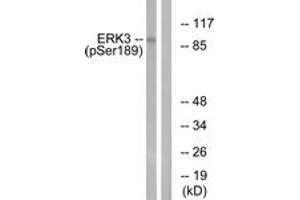Western blot analysis of extracts from mouse brain, using ERK3 (Phospho-Ser189) Antibody.