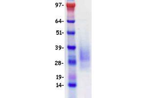 Image no. 1 for B-cell antigen receptor complex-associated protein alpha chain (CD79A) (Transcript Variant 1) protein (DYKDDDDK-His Tag) (ABIN2713776)