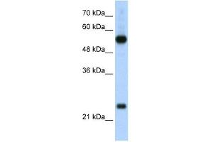 Image no. 1 for anti-Ribosomal Protein L13 (RPL13) (C-Term) antibody (ABIN630043)