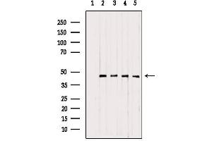 Image no. 2 for anti-Ubiquinol-Cytochrome C Reductase Core Protein I (UQCRC1) (C-Term) antibody (ABIN6265899)