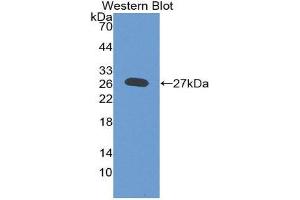 Image no. 1 for anti-Heparan Sulfate Proteoglycan 2 (HSPG2) (AA 4149-4391) antibody (ABIN2119195)