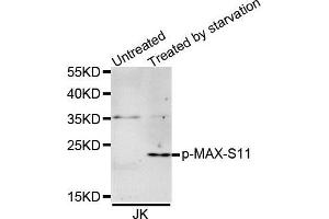 Image no. 2 for anti-MYC Associated Factor X (MAX) (pSer11) antibody (ABIN3019515)