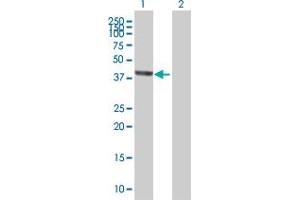 Image no. 2 for anti-SEC14-Like 2 (SEC14L2) (AA 1-392) antibody (ABIN525233)