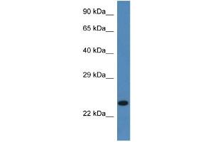 Image no. 1 for anti-Signal Sequence Receptor, beta (Translocon-Associated Protein Beta) (SSR2) (C-Term) antibody (ABIN2782214)