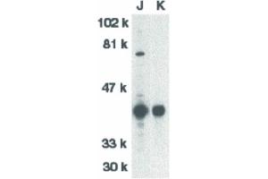Image no. 3 for anti-DNA Fragmentation Factor, 40kDa, beta Polypeptide (Caspase-Activated DNase) (DFFB) (N-Term) antibody (ABIN6655306)