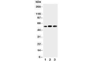 Western blot testing of KIN17 antibody and Lane 1:  rat skeletal muscle;  2: human placenta;  3: rat testis tissue lysate