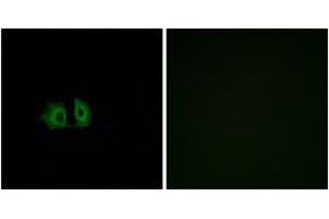 Image no. 2 for anti-Frizzled Family Receptor 5 (FZD5) (AA 461-510) antibody (ABIN1535683)