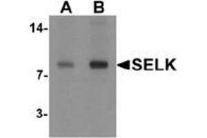 Image no. 1 for anti-Selenoprotein K (SELK) (C-Term) antibody (ABIN1450003)