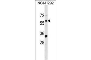 Image no. 1 for anti-ZINC FINGER PROTEIN 136 (ZNF136) (AA 104-133), (N-Term) antibody (ABIN5533013)