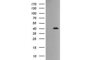 Image no. 2 for anti-Mitogen-Activated Protein Kinase 13 (MAPK13) antibody (ABIN1499952)